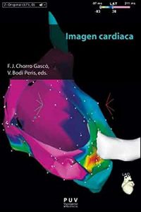 Baixar Imagen cardiaca pdf, epub, eBook