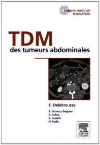 Baixar TDM des tumeurs abdominales pdf, epub, eBook