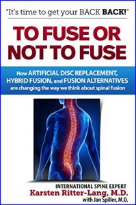 Baixar To Fuse or Not to Fuse: How Artificial Disc Replacement, Hybrid Fusion, and Fusion Alternatives are Changing the World of Spinal Fusion (English Edition) pdf, epub, eBook