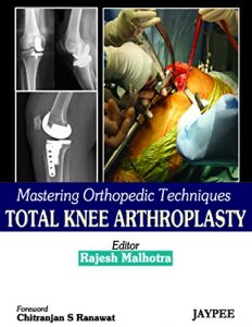 Baixar Mastering Orthopedic Techniques Total Knee Arthroplasty pdf, epub, eBook