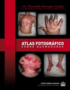 Baixar Atlas Fotografico Sobre Quemaduras (Spanish Edition) pdf, epub, eBook