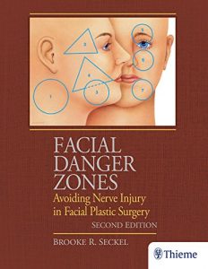 Baixar Facial Danger Zones: Avoiding Nerve Injury in Facial Plastic Surgery pdf, epub, eBook