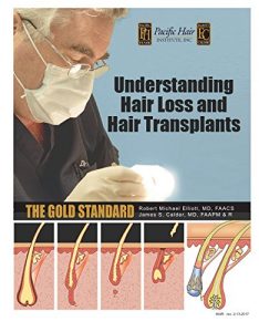 Baixar Understanding Hair Loss and Hair Transplants (rev: 2-13-2017) (English Edition) pdf, epub, eBook
