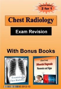 Baixar Chest Radiology: Exam Revision Made Easy (English Edition) pdf, epub, eBook