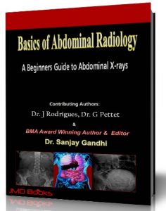 Baixar Basics of Abdominal Radiology (English Edition) pdf, epub, eBook