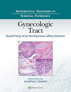 Baixar Differential Diagnoses in Surgical Pathology: Gynecologic Tract pdf, epub, eBook
