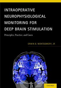 Baixar Intraoperative Neurophysiological Monitoring for Deep Brain Stimulation: Principles, Practice and Cases pdf, epub, eBook