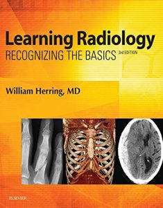 Baixar Learning Radiology E-Book: Recognizing the Basics pdf, epub, eBook