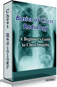 Baixar Basics of Chest Radiology – New Edition (English Edition) pdf, epub, eBook
