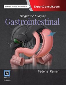 Baixar Diagnostic Imaging: Gastrointestinal E-Book pdf, epub, eBook