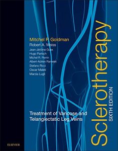 Baixar Sclerotherapy E-Book: Treatment of Varicose and Telangiectatic Leg Veins (Expert Consult) pdf, epub, eBook