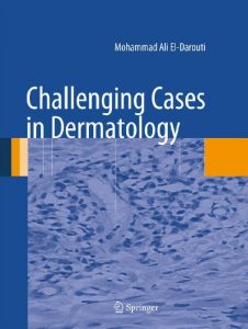 Baixar Challenging Cases in Dermatology pdf, epub, eBook
