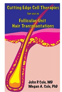 Baixar Cutting Edge Cell Therapies for use in Follicular Unit Hair Transplantations (English Edition) pdf, epub, eBook