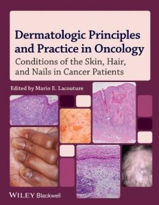 Baixar Dermatologic Principles and Practice in Oncology: Conditions of the Skin, Hair, and Nails in Cancer Patients pdf, epub, eBook