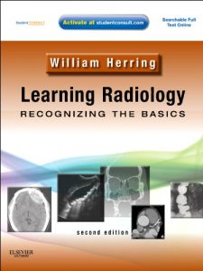 Baixar Learning Radiology: Recognizing the Basics E-Book pdf, epub, eBook