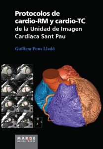 Baixar Protocolos de cardio-RM y cardio-TC de la Unidad de Imagen Cardiaca Sant Pau (Spanish Edition) pdf, epub, eBook