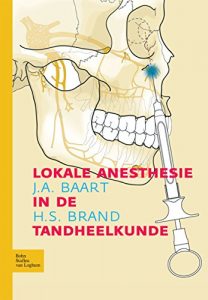 Baixar Lokale anesthesie in de tandheelkunde pdf, epub, eBook
