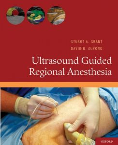 Baixar Ultrasound Guided Regional Anesthesia pdf, epub, eBook