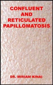 Baixar Dermatology: Confluent and Reticulated Papillomatosis (Skin Diseases Book 40) (English Edition) pdf, epub, eBook