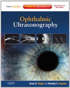 Baixar Ophthalmic Ultrasonography E-Book: Expert Consult – Online and Print pdf, epub, eBook