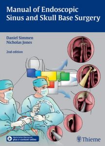 Baixar Manual of Endoscopic Sinus and Skull Base Surgery pdf, epub, eBook