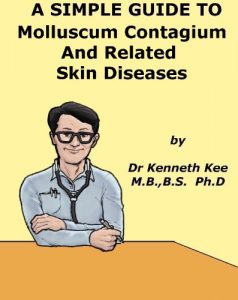 Baixar A Simple Guide to Molluscum Contagiosum and Related Skin Diseases (A Simple Guide to Medical Conditions) (English Edition) pdf, epub, eBook