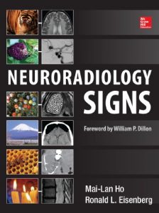 Baixar Neuroradiology Signs pdf, epub, eBook