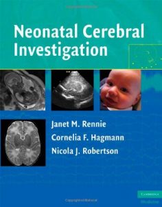 Baixar Neonatal Cerebral Investigation pdf, epub, eBook