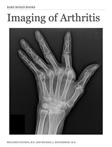 Baixar Imaging of Arthritis (English Edition) pdf, epub, eBook