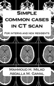 Baixar Simple common cases in CT scan: For interns and new residents (English Edition) pdf, epub, eBook