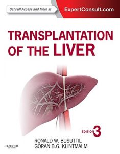 Baixar Transplantation of the Liver E-Book pdf, epub, eBook