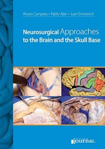 Baixar Neurosurgical Approaches to the Brain and the Skull Base (Spanish Edition) pdf, epub, eBook