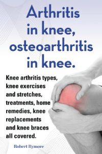 Baixar Arthritis in knee, osteoarthritis in knee. Knee arthritis exercises and stretches, treatments, home remedies, knee replacements and knee braces all covered. (English Edition) pdf, epub, eBook