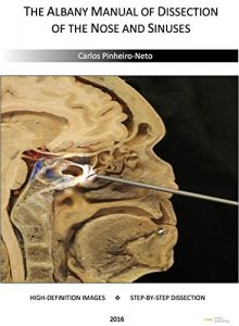 Baixar ALBANY MANUAL OF DISSECTION OF THE NOSE AND SINUSES: 51 HIGH-DEFINITION PICTURES     |     STEP-BY-STEP DISSECTION (English Edition) pdf, epub, eBook
