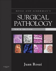 Baixar Rosai and Ackerman’s Surgical Pathology (Surgical Pathology (Ackerman’s)) pdf, epub, eBook