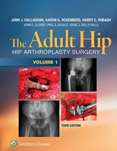 Baixar The Adult Hip: Hip Arthroplasty Surgery pdf, epub, eBook