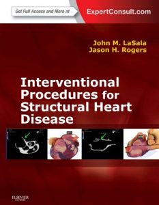 Baixar Interventional Procedures for Adult Structural Heart Disease E-Book: Expert Consult – Online pdf, epub, eBook