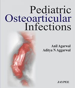 Baixar Pediatric Osteoarticular Infections pdf, epub, eBook