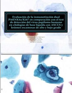 Baixar EVALUACION DE LA INMUNOTINCION DUAL P16INK4a/Ki67 EN COMPARACION CON EL TEST DEL VIRUS DEL PAPILOMA HUMANO EN CITOLOGIAS DE BASE LIQUIDA CON ASCUS Y LESIONES … DE ALTO Y BAJO GRADO (Spanish Edition) pdf, epub, eBook