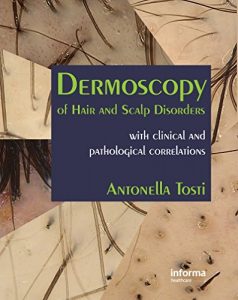 Baixar Dermoscopy of Hair and Scalp Disorders: With Clinical and Pathological Correlations pdf, epub, eBook