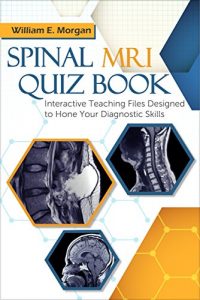 Baixar Spinal MRI Quiz Book: Interactive Teaching Files Designed to Hone Your Diagnostic Skills (English Edition) pdf, epub, eBook