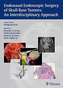 Baixar Endonasal Endoscopic Surgery of Skull Base Tumors: An Interdisciplinary Approach pdf, epub, eBook
