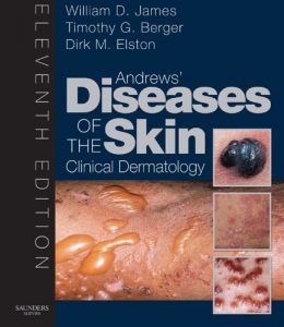 Baixar Andrew’s Diseases of the Skin E-Book: Clinical Dermatology (James, Andrew’s Disease of the Skin) pdf, epub, eBook