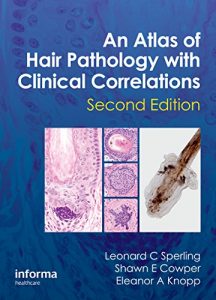 Baixar An Atlas of Hair Pathology with Clinical Correlations, Second Edition pdf, epub, eBook