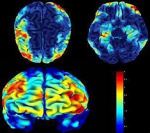 Baixar A Case Study: Oliver Sacks, MD Interviewed (English Edition) pdf, epub, eBook