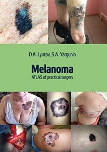 Baixar Melanoma. Atlas of Practical Surgery (1) (English Edition) pdf, epub, eBook