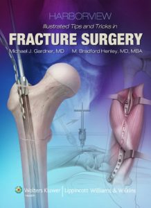 Baixar Harborview Illustrated Tips and Tricks in Fracture Surgery pdf, epub, eBook
