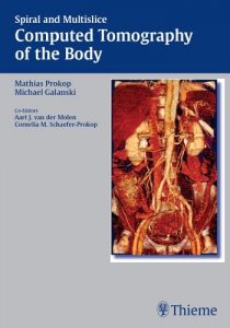 Baixar Spiral and Multislice Computed Tomography of the Body pdf, epub, eBook