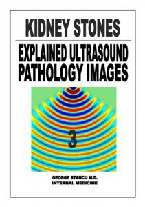 Baixar KIDNEY STONES (Explained Ultrasound Pathology Images Book 3) (English Edition) pdf, epub, eBook