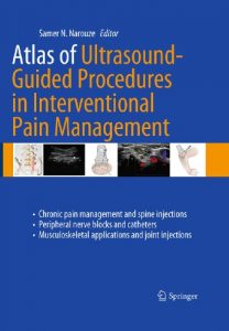 Baixar Atlas of Ultrasound-Guided Procedures in Interventional Pain Management pdf, epub, eBook